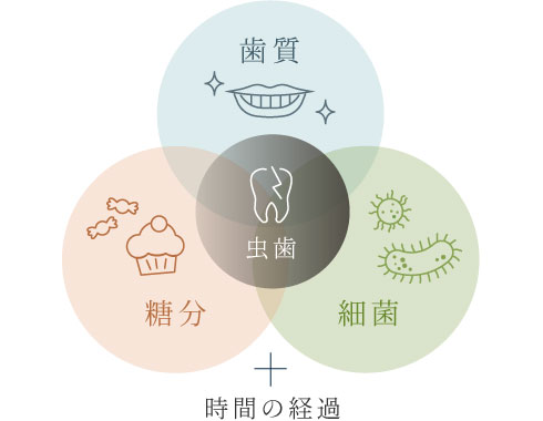 虫歯の原因は「歯質」「糖分」「細菌」と「時間の経過」